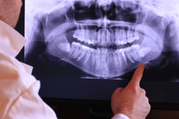 Best Teeth Whitening  in Kouts, IN