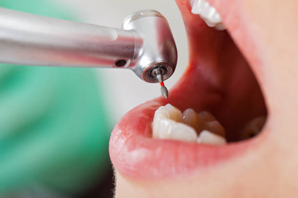 Emergency Dentist for Kids in IN